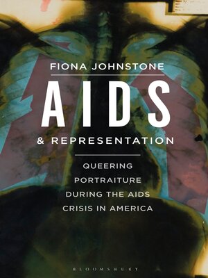 cover image of AIDS and Representation